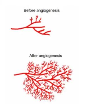 What Is Angiogenesis?